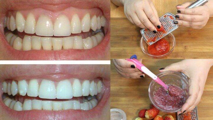 DIY Naturally Teeth Whitening Remedies