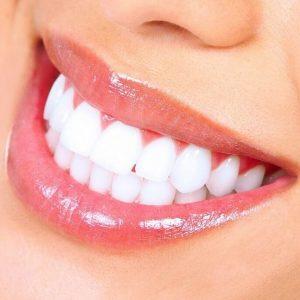 DIY Teeth Whitening Activated Charcoal Tips