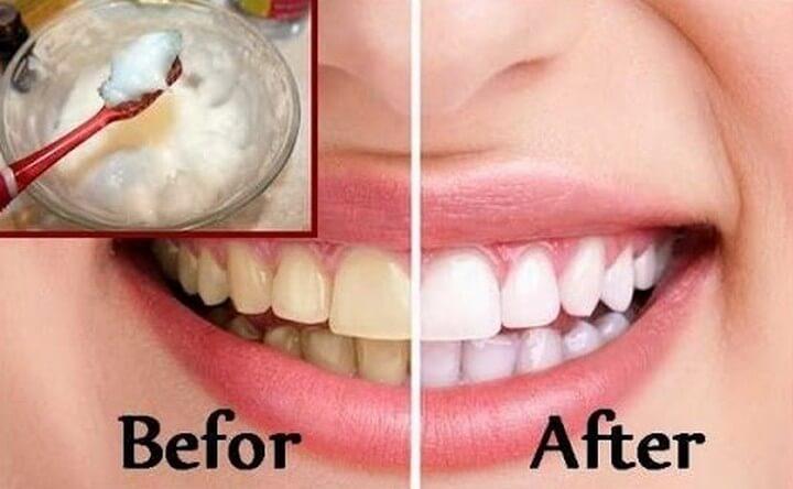 DIY Teeth Whitening at Home in 2 minutes