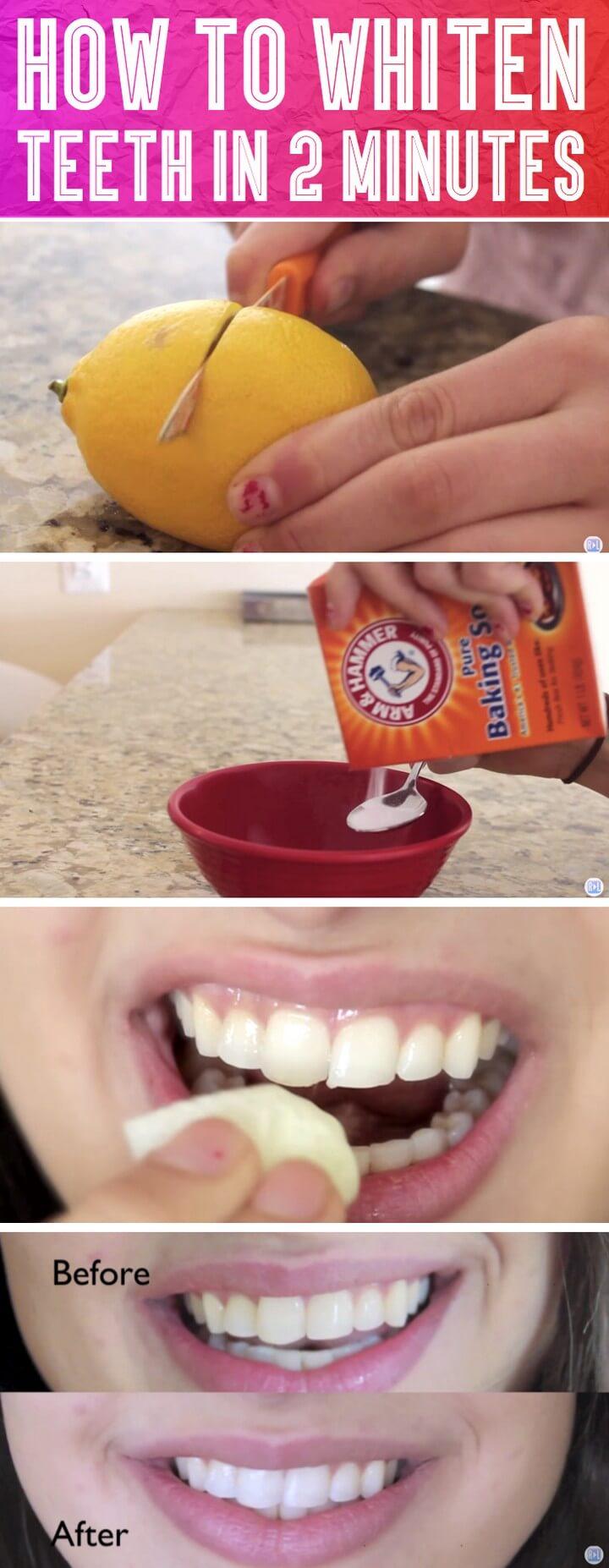 Whiten Teeth in 2 Minutes DIY