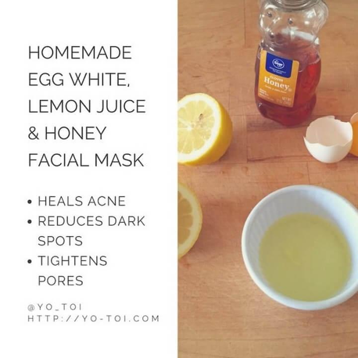Egg White Lemon Juice Honey Facial Mask for Acne Scars