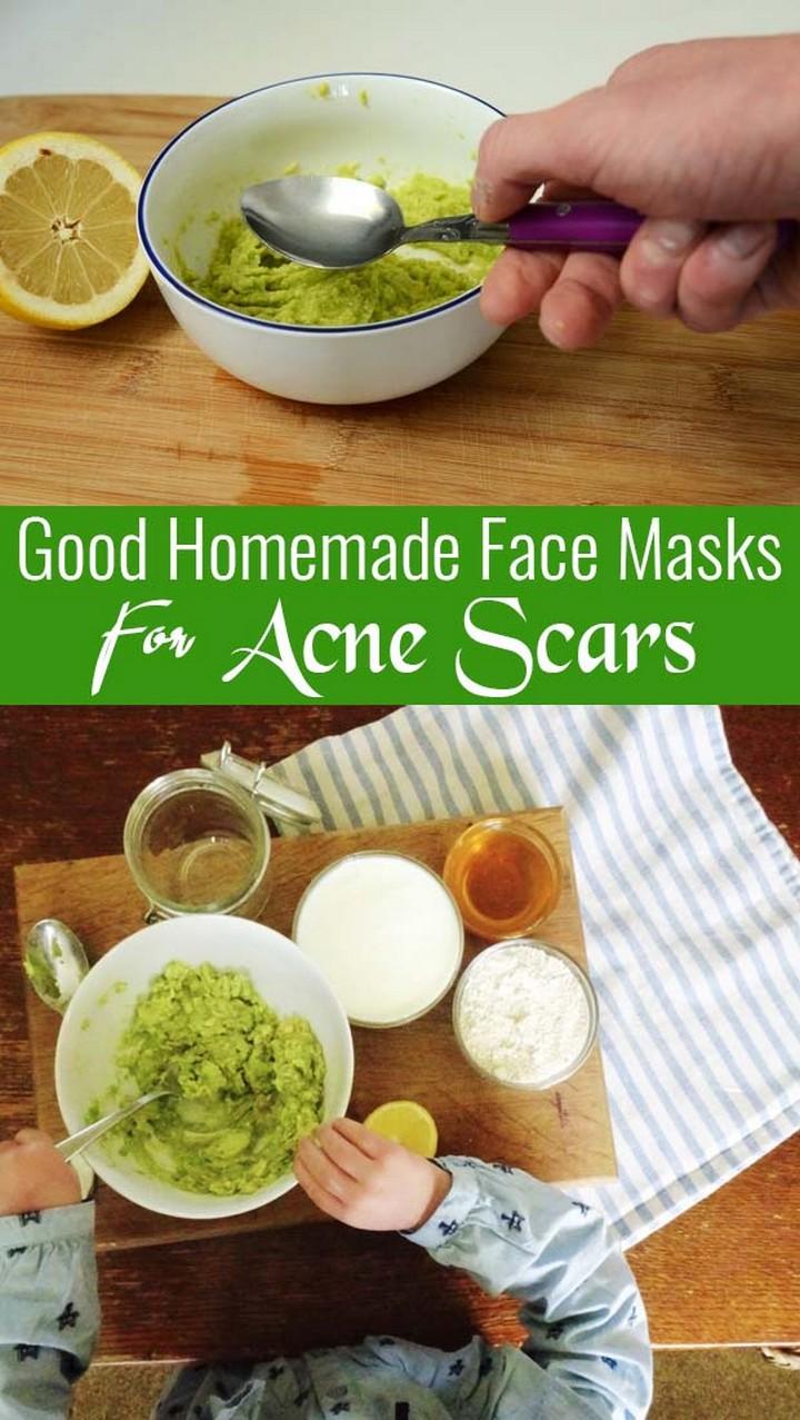 Homemade Face Mask For Pores And Blackheads