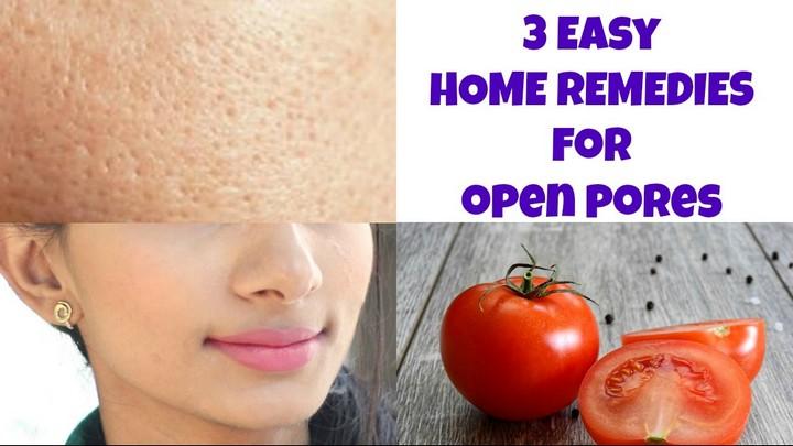 Open Pores Home Remedy