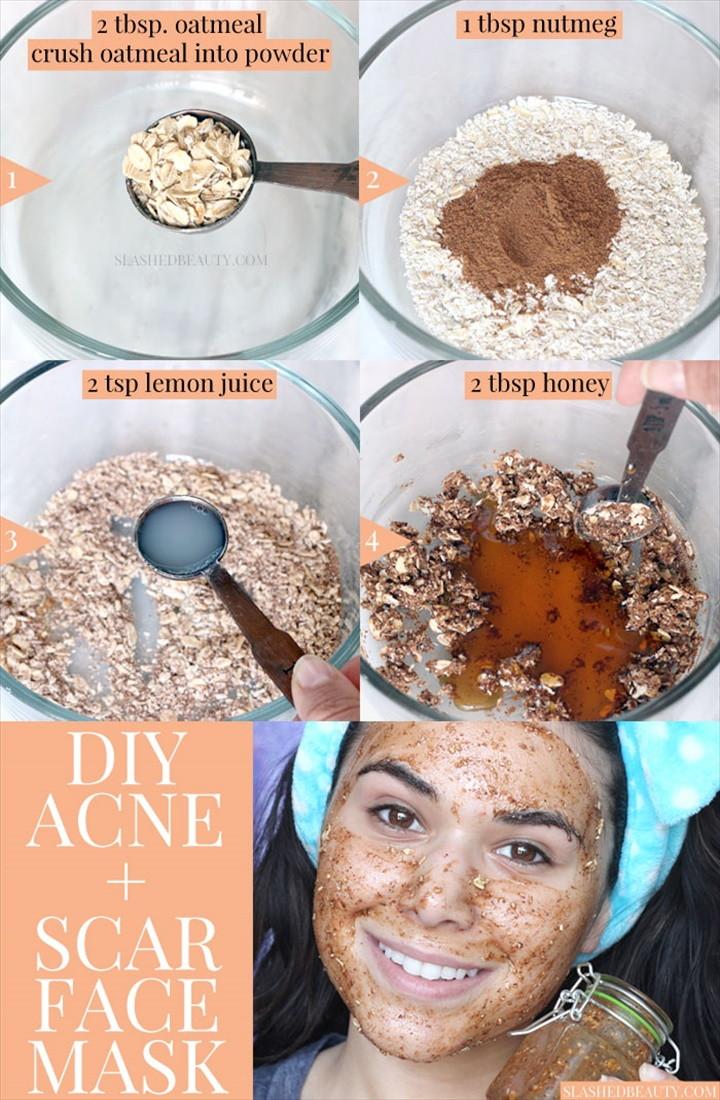 Best DIY Face Mask for Acne Acne Scars