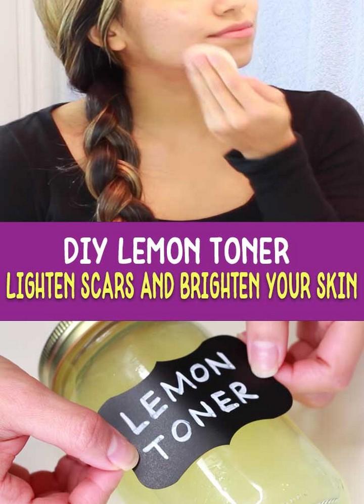 DIY Lemon Toner – Lighten Acne Scars Naturally