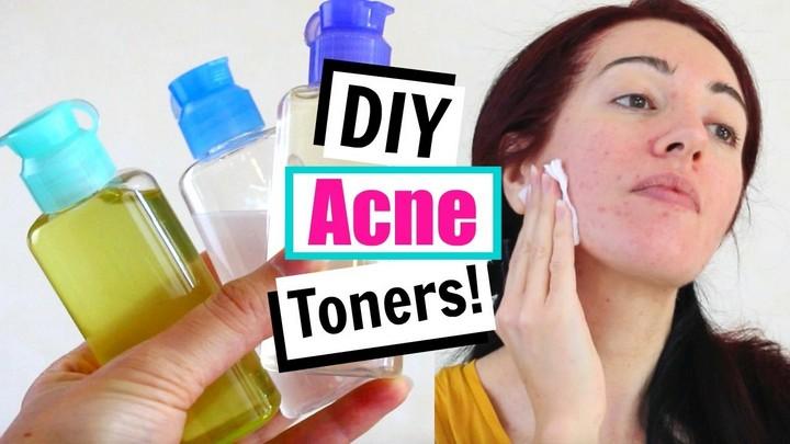 DIY Toner For Acne Oily Skin Home Remedies For Acne
