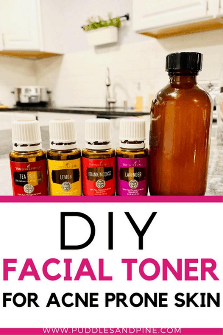 DIY Toner For Oily And Acne Prone Skin 1