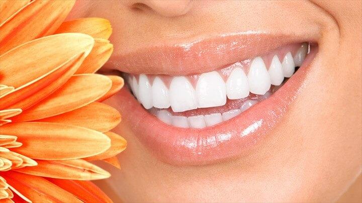 Tooth Whitening Recipe